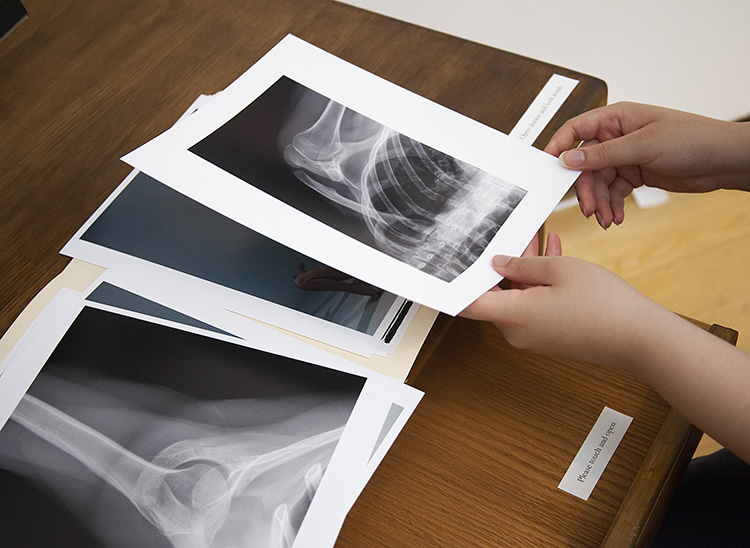 hands holding a printout of an x-ray of ribs