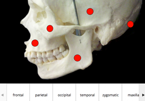 Example of drag-and-drop skeletal feature identification
