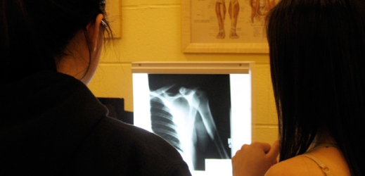 students study a rib cage x-ray